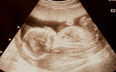 河北生殖妇产医院生殖科介绍，试管成功率有多高一看便知