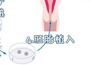 在井冈山大学附属医院做试管婴儿要多少钱？成功率怎么样？附试管怀孕机构名单一览